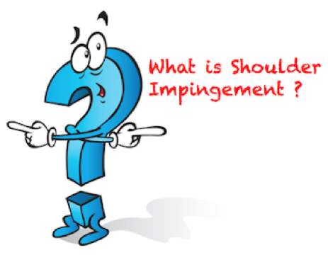 What are some symptoms of shoulder impingement syndrome?